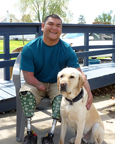 man with amputated legs and hand sitting in lawn chair next to yellow Lab